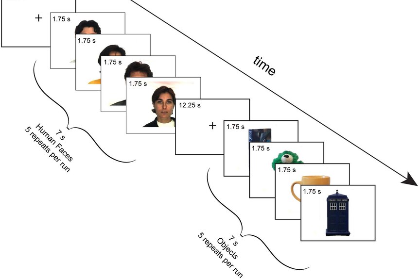 Visual stimulation paradigm