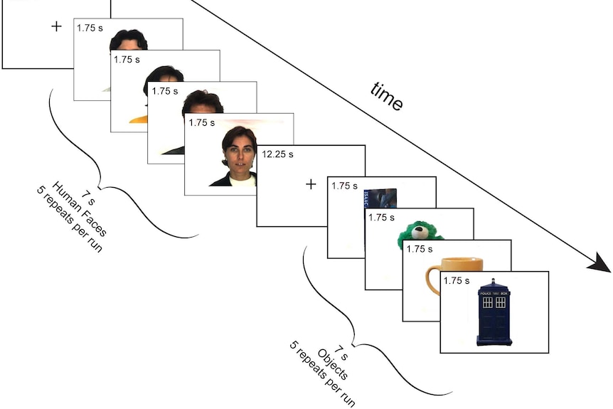 Visual stimulation paradigm