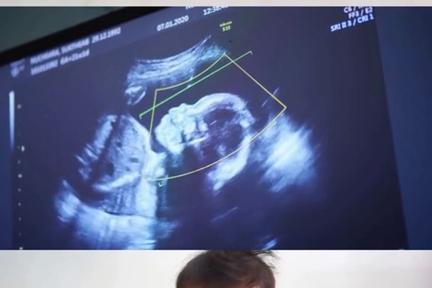 Composite shot shows three images of baby photos and a radio scan