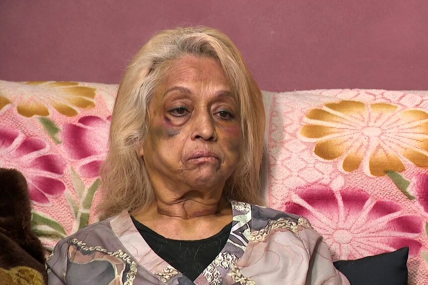 A woman with bruises on her face sits on a colourful pink couch