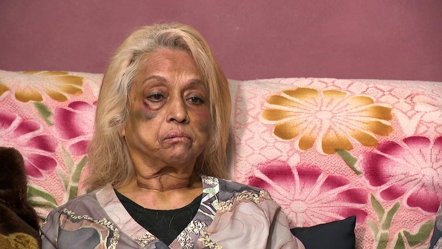 A woman with bruises on her face sits on a colourful pink couch