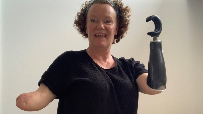 Woman grins and wears a prosthetic limb on one arm 