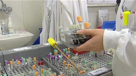 A scientists with a tray of pathology tests