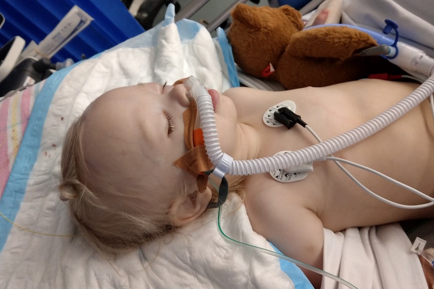 A young toddler recovers in ICU, a breathing tube over her nose