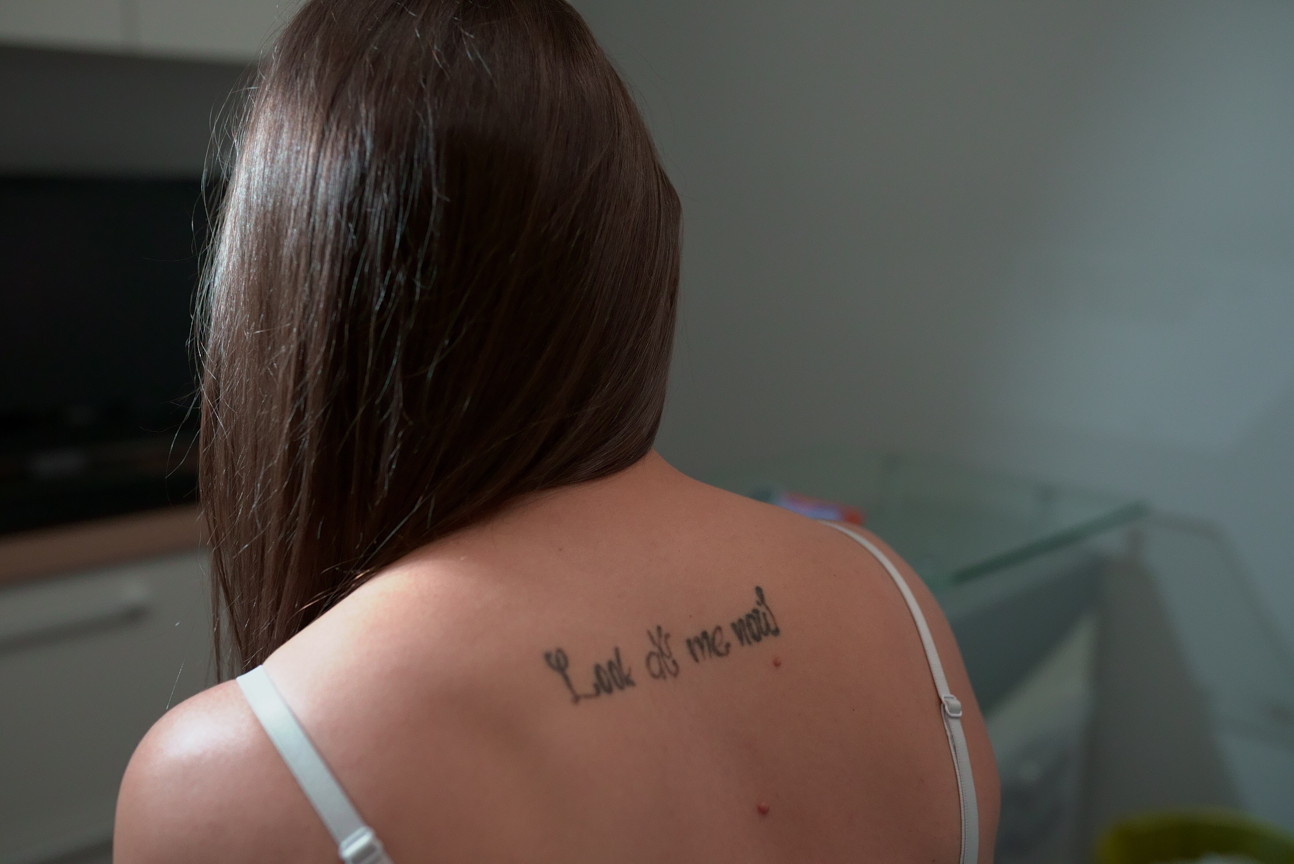 Tattoo Removalist Amanda Mckinnon S Fresh Start Program Helping People Begin New Chapters Abc News