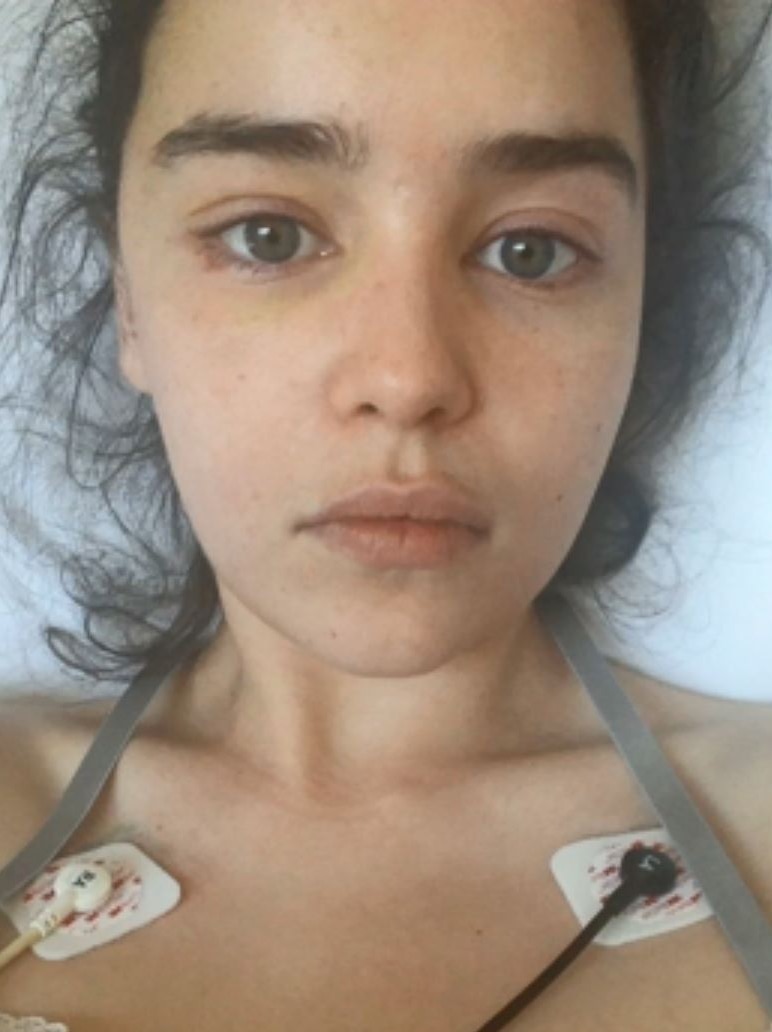 Head-and-shoulders shot of Emilia Clarke lying on a bed in hospital.