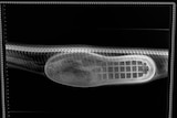 X-ray of a slipper swallowed by a Coastal Carpet Python in Queensland, which had the object removed by a vet.