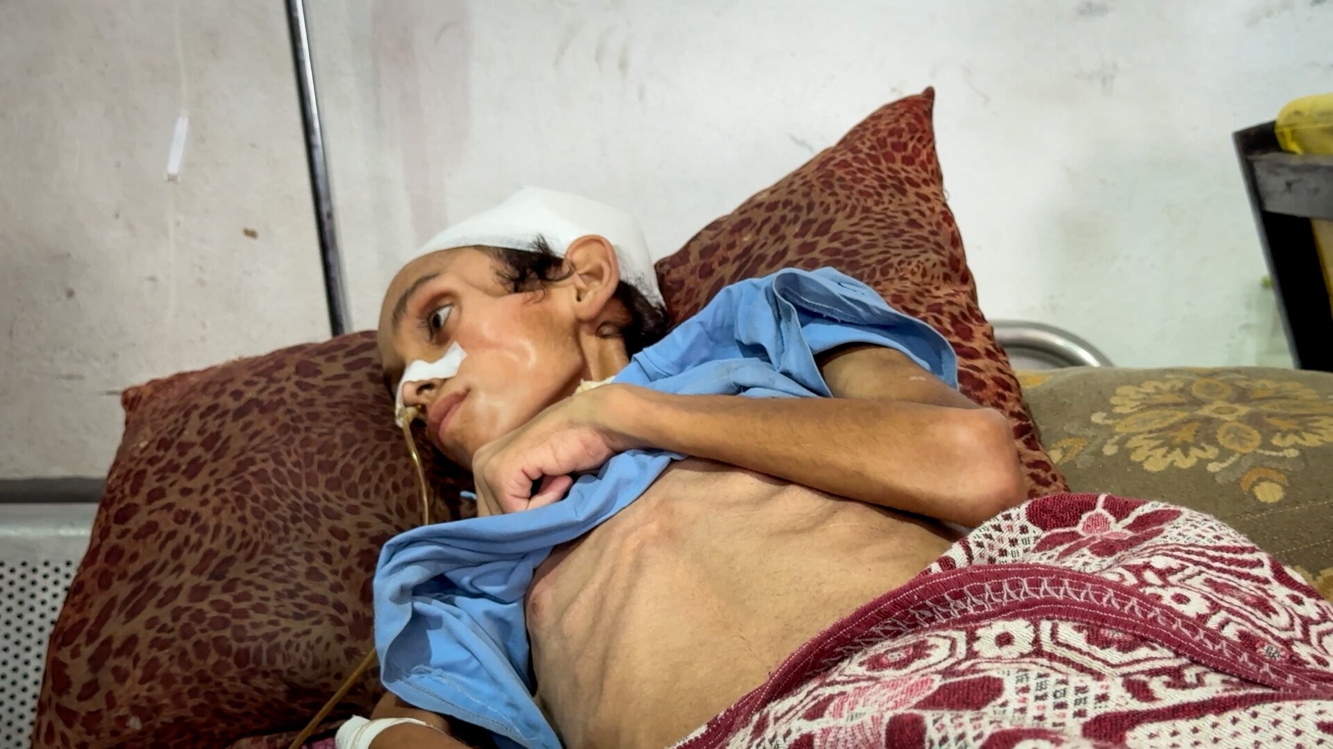 An emaciated 14-year-old boy lying on a bed, his face gaunt and ribs clearly visible.
