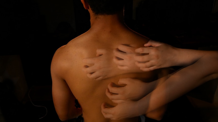 Young man's naked back with multiple hands superimposed scratching an itch in different spots on the back.