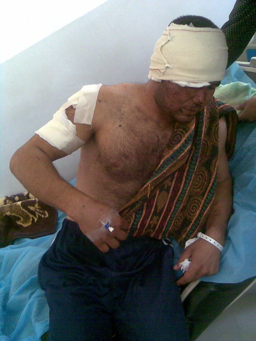 A man sitting with bandages around his head.