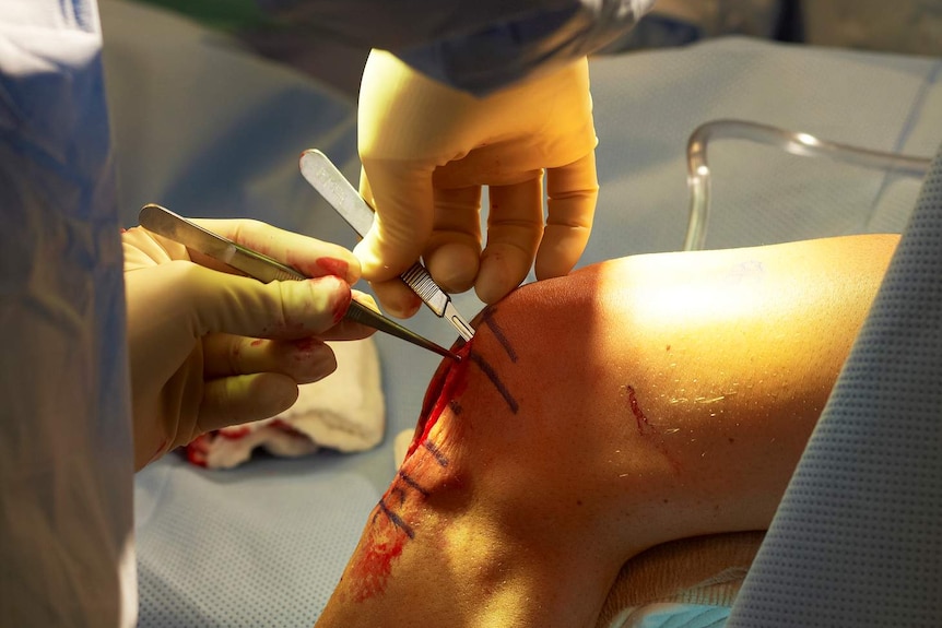 A surgeon's gloved hands hold tools against a knee.