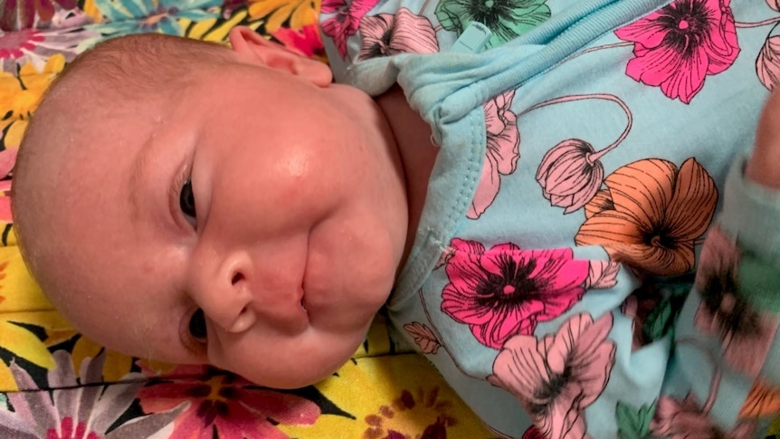 A picture of a baby lying on its side, smiling and in a blue jump suit with flowers on it.