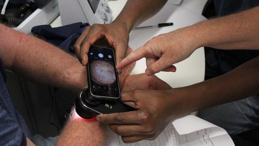 A skin cancer patient being checked with a dermatoscope
