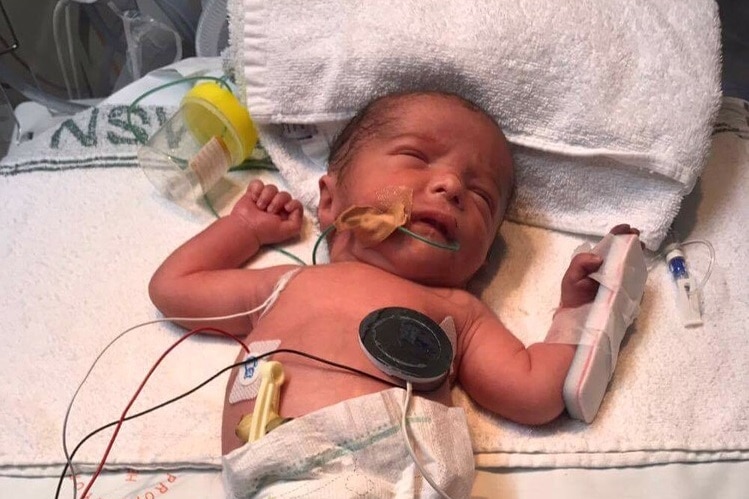 Yana Williams' son, Kyzan, was born premature and relied on breast milk to boost his immune system and fight infection