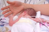 Hand of the physician and newborn in incubator in hospital