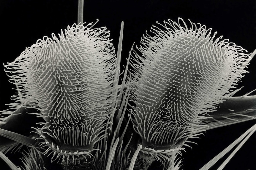 A micrograph revealing the hairy fibres on a fly's feet