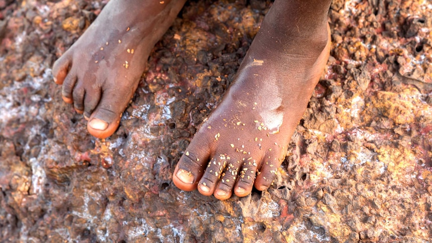 high quality close up image of a small pair of dark skinned feet standing on a textured beach rock