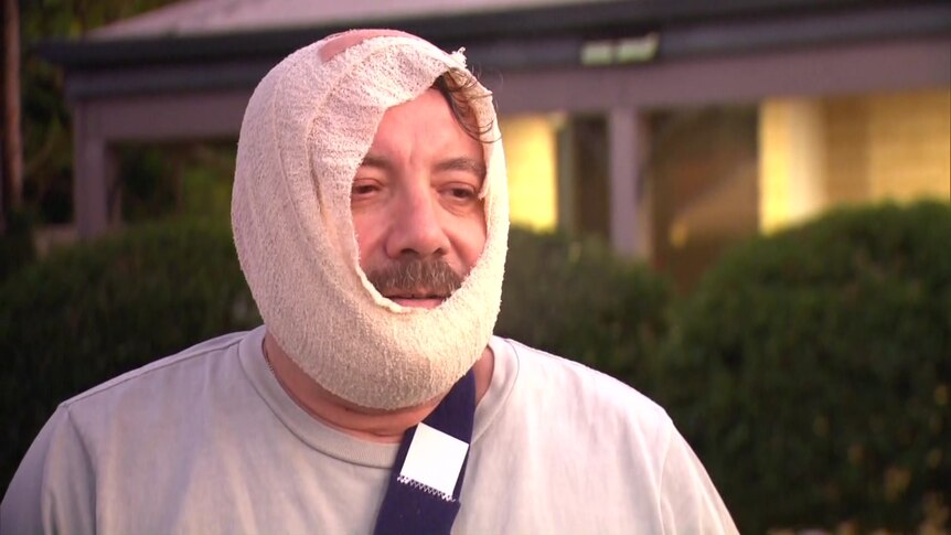 Stephen Quayle with bandages surrounding his face after the attack.