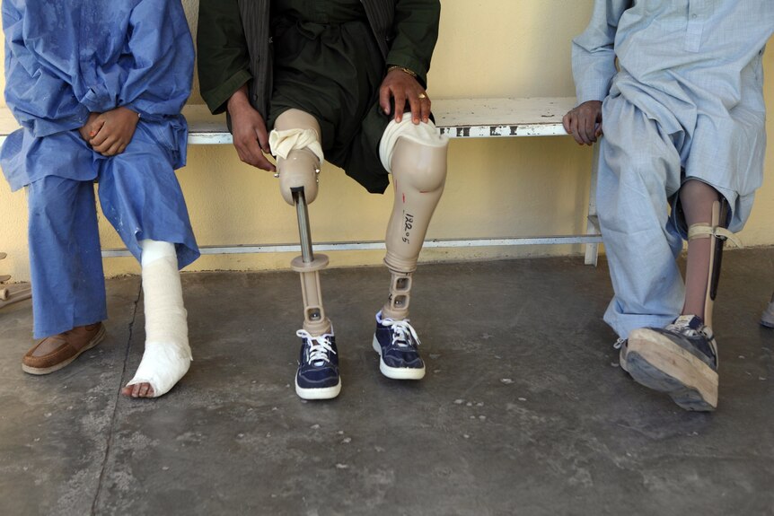 Landmine victims await attention from doctors in Kabul, Afghanistan (Getty Images)