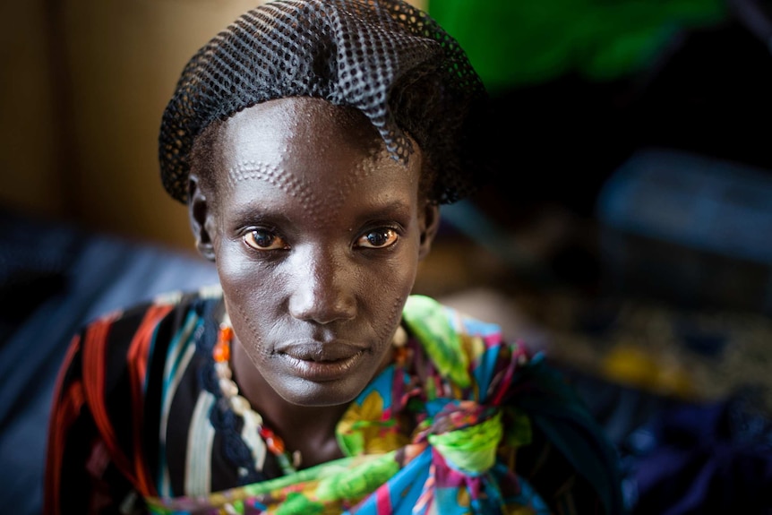 A young woman waits in a MSF clinic in Gogrial, South Sudan.