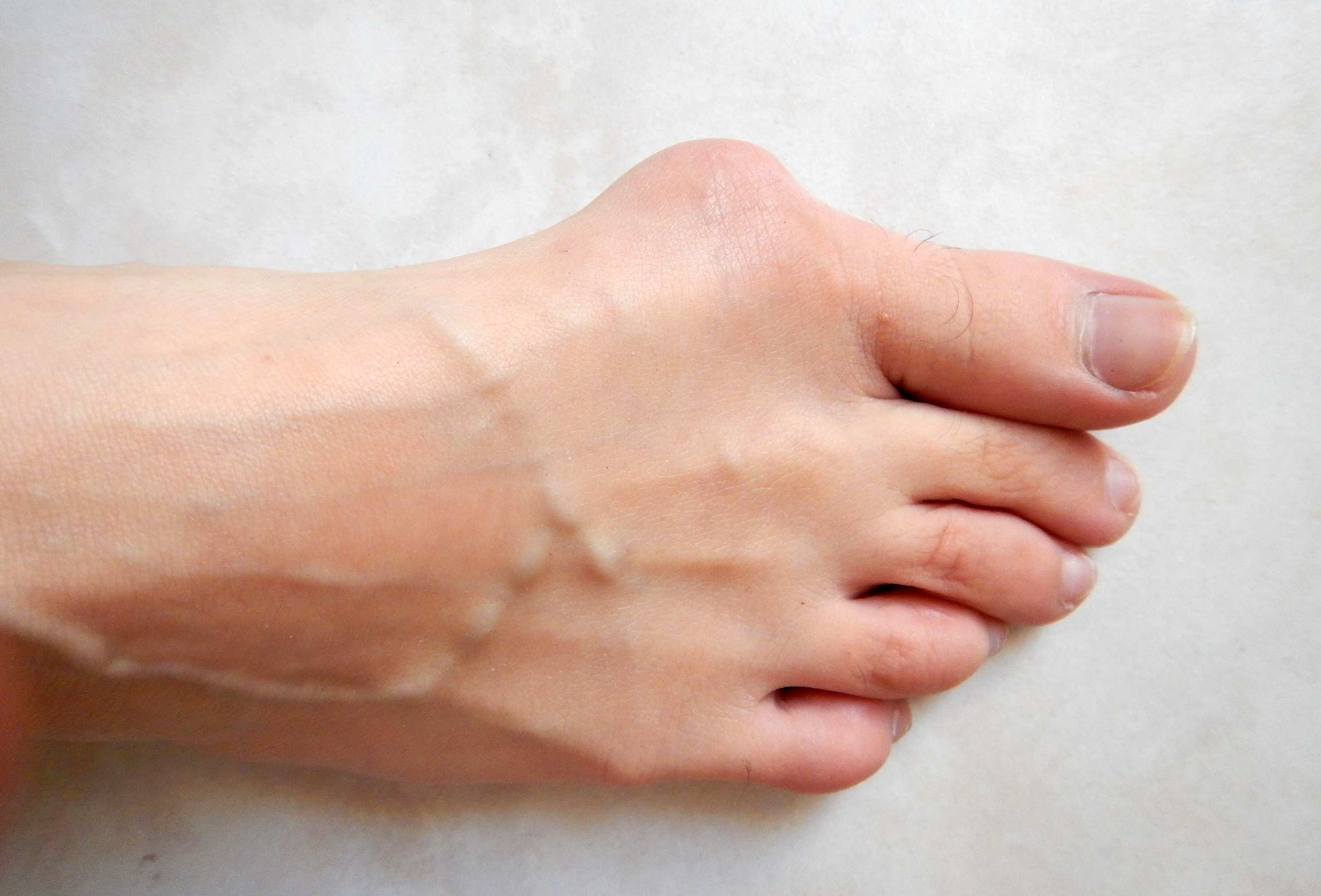 shoes for wide feet with bunions australia