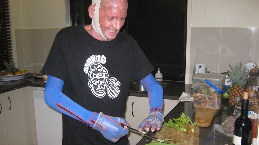 Matt Golinski cooks his first homemade meal since leaving hospital in 2012.