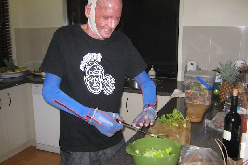 Matt Golinski cooks his first homemade meal since leaving hospital in 2012.