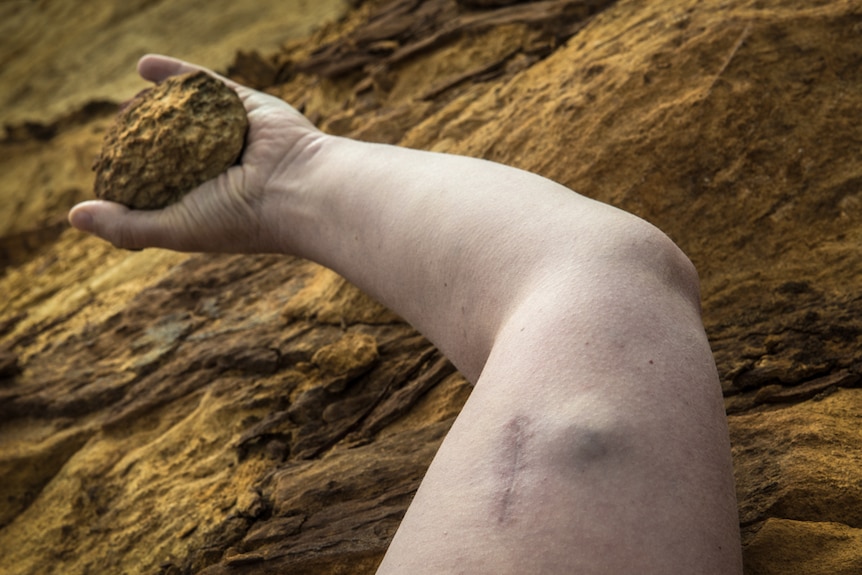 A woman's arm, photographed on bare dirt. The woman holds a rock in one hand, and a scar is visible on her upper arm.