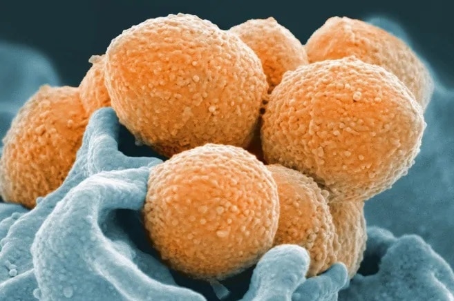 A microscopic picture of streptococcal