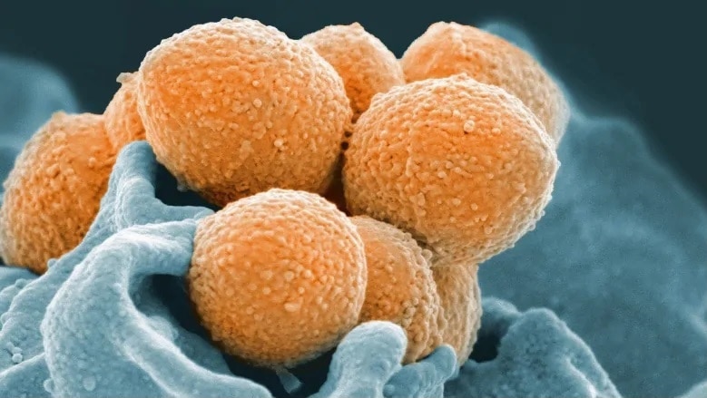 A microscopic picture of streptococcal