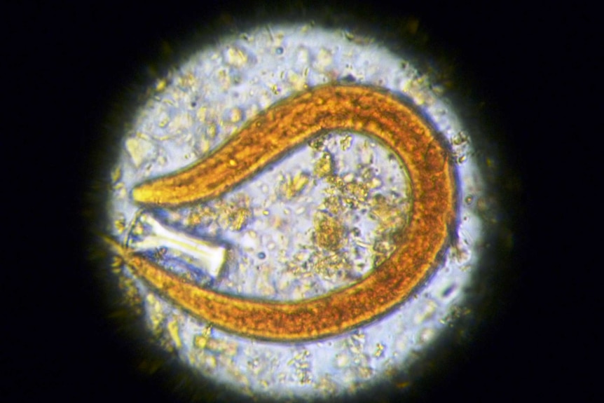 A strongyloides stercoralis under a microscope.