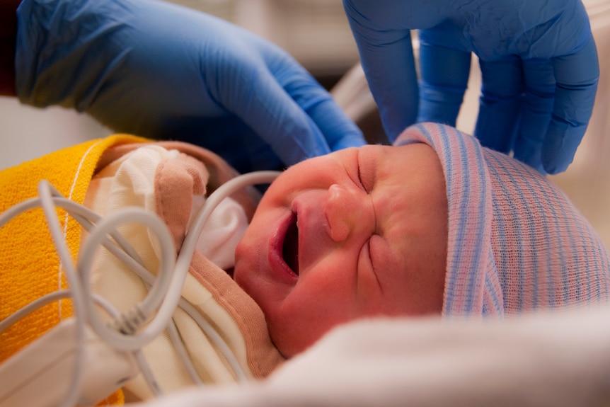 A baby receiving a hearing test.