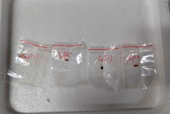 Fungus are being sealed in four plastic bags