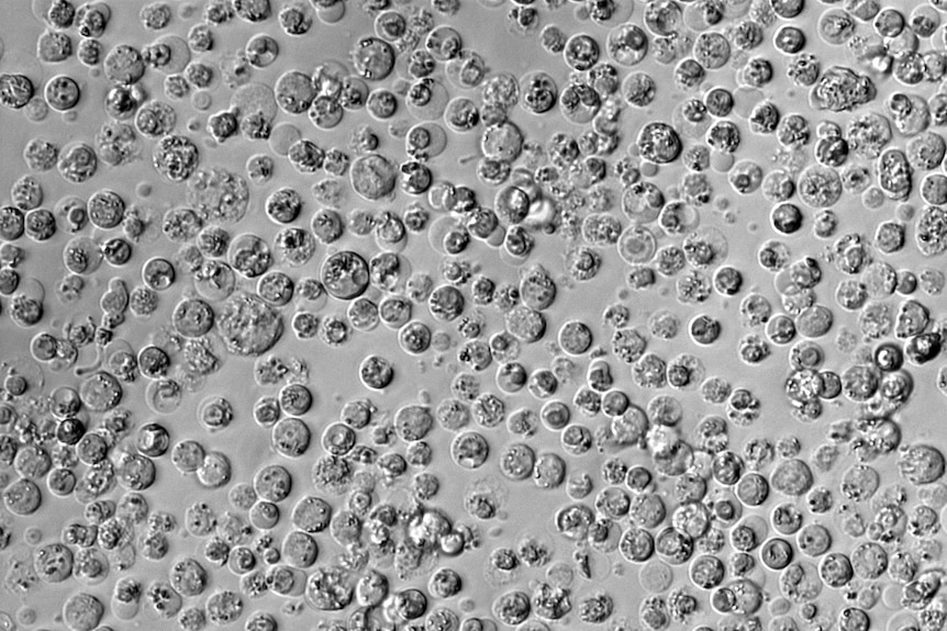 Burkitt Lymphoma cells after CRISPR