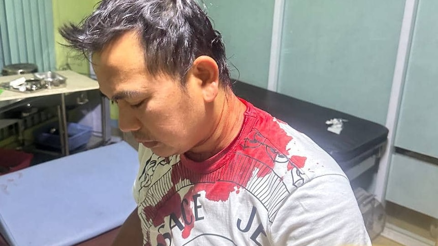A man sitting in a doctor's surgery with a head wound a blood around the nap of his t-shirt.