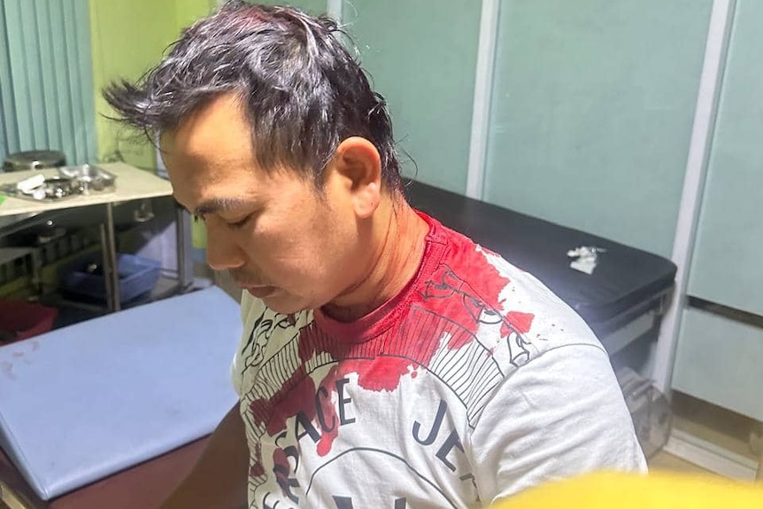 A man sitting in a doctor's surgery with a head wound a blood around the nap of his t-shirt.
