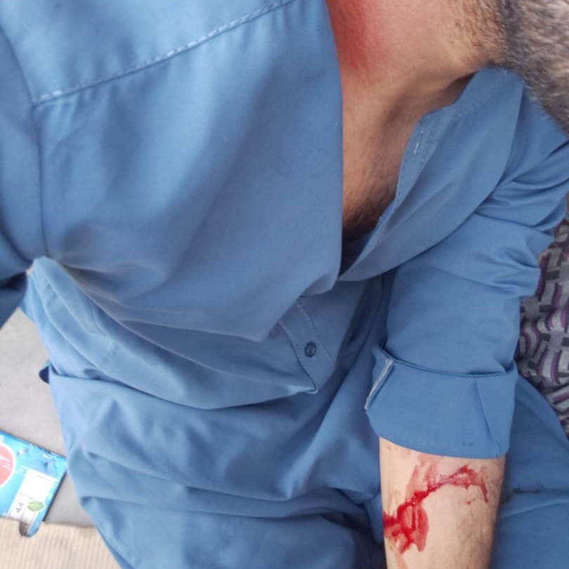  Ahmadullah holds his bleeding arm after being stabbed by a man.