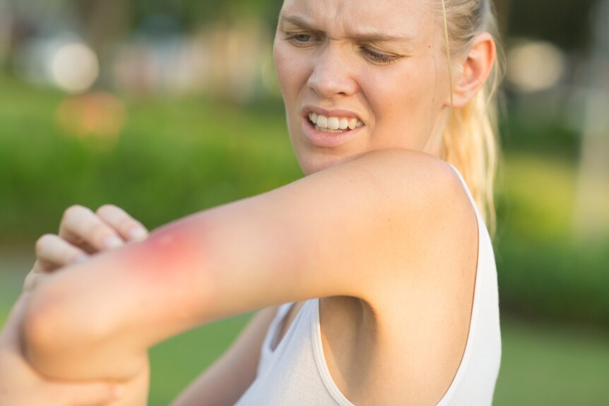 Annoyed woman in a park finds a mosquito bite
