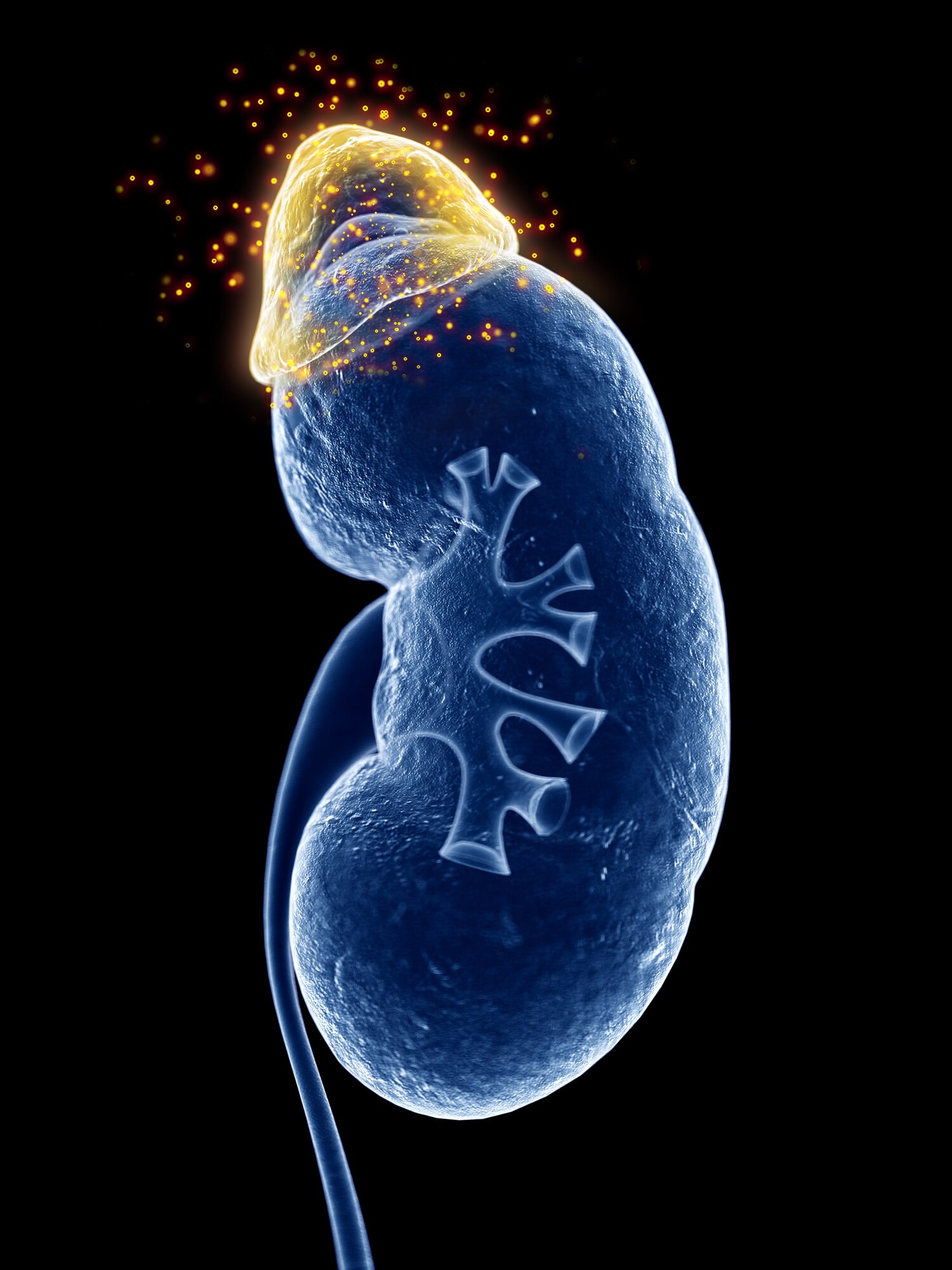 An illustration of a kidney with the triangular adrenal gland sitting on top