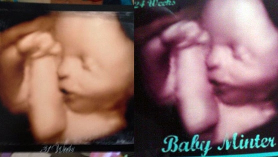 Charges over 'fake' baby ultrasounds