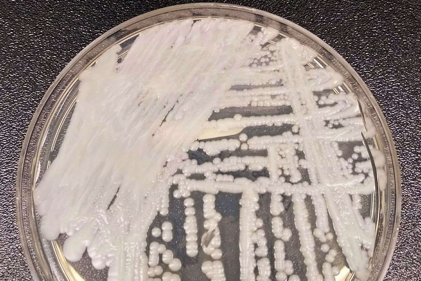 A fungus growing on an agar plate