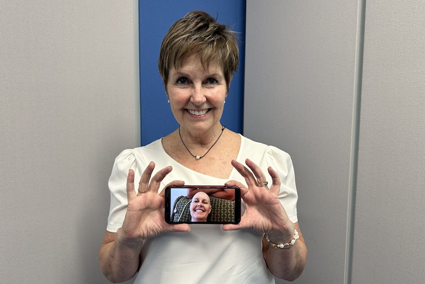 A smiling woman holds up her phone, which shows a photo of her without hair.