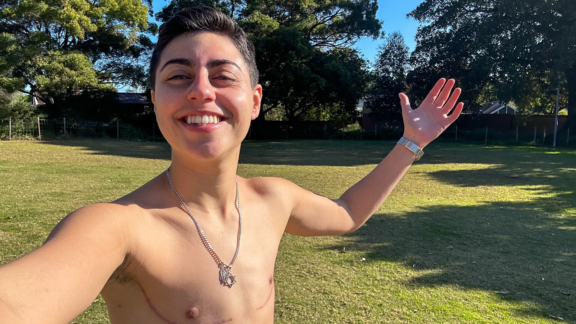 Speedy takes a shirtless selfie, their top surgery scars on show, grinning in the sunshine.