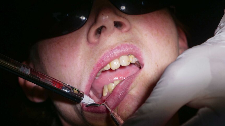 Close up shot of a woman's mouth, being treated by a dentist.