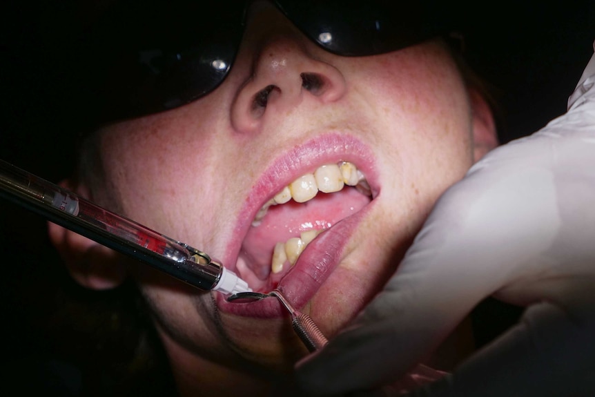Close up shot of a woman's mouth, being treated by a dentist.