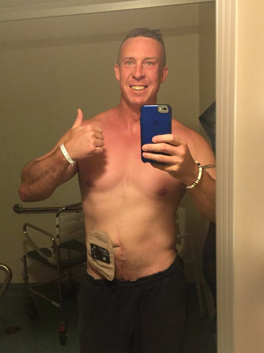 Warren takes a selfie following bowel surgery.