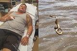 Peter Davis in hospital with a bandaged finger after being bitten by a sea snake