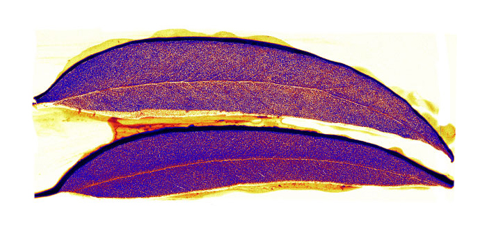 X-rays of eucalypt leaves showing particles of gold