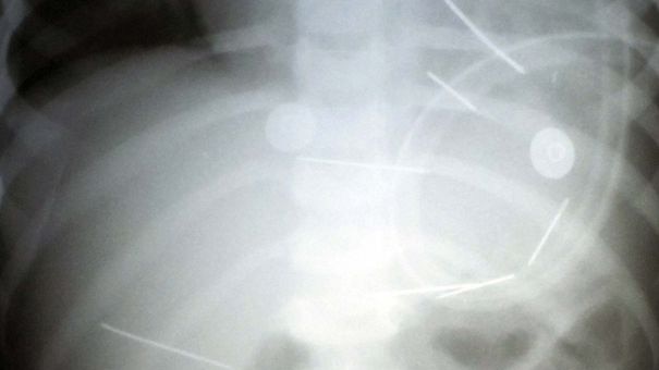 x-ray image.