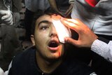 An Egyptian protester wounded in the eye is treated at a field hospital.